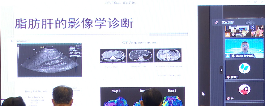 會(huì)議動(dòng)態(tài)｜湖北省非酒精性脂肪性肝病學(xué)術(shù)聯(lián)盟正式成立